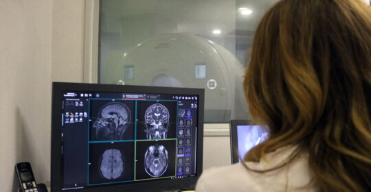 La neurología cuenta con un nuevo aliado, una nueva resonancia magnética es capaz de captar las lesiones de difícil diagnóstico.
