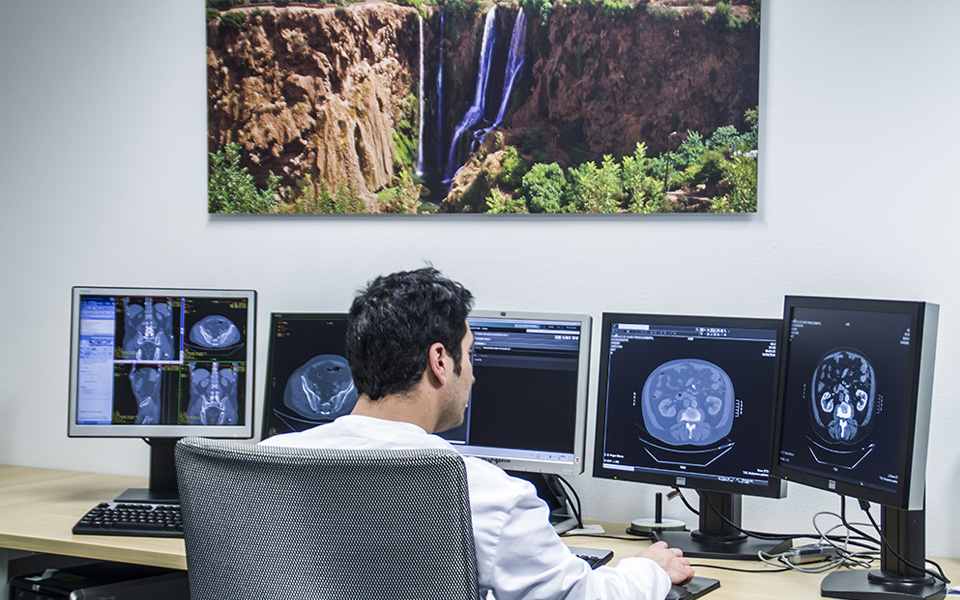 La resonancia magnética, clave en el control de los gliomas de bajo grado