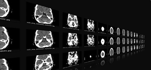 ¿Cuándo se realiza un TAC o Tomografía Axial Computarizada ?