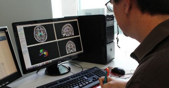 Se han realizado los primeros estudios óptimos para detectar esquizofrenia con resonancia magnética y PET