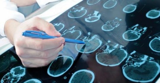 El TAC Cerebral: Información y preparación