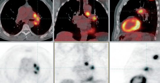 Las exploraciones con técnicas de imagen indispensables para tratamientos contra el cáncer