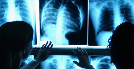 La radiología es la madre de muchos diagnósticos