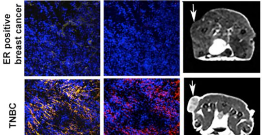 Desarrollo de un nuevo agente de contraste para resonancias magnéticas para la detección de cáncer de mama