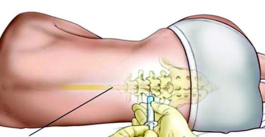 Tumor cerebral: nueva técnica para un mejor diagnóstico.