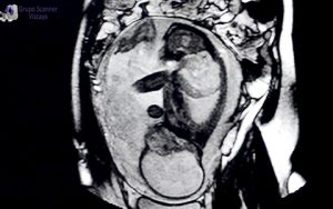 Imagenes RM fetal