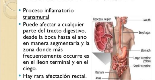 Investigan si un trasplante de células madre puede tratar la enfermedad de Crohn