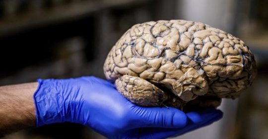 Desarrollada una nueva técnica para visualizar el tejido cerebral, a traves del TAC