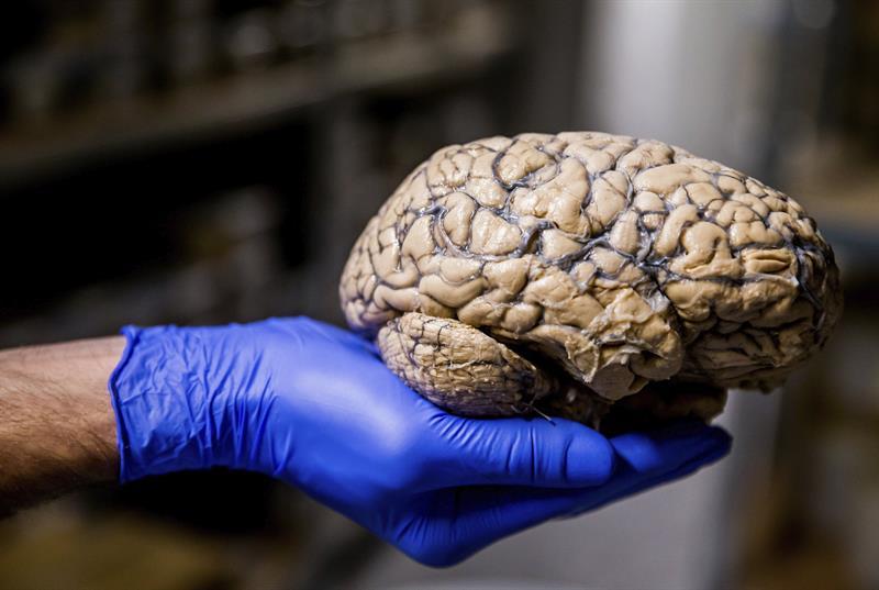 El TAC revoluciona el estudio del tejido cerebral