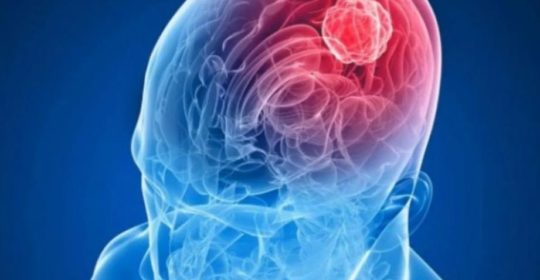 Vacunas de inmunoterapia en el cáncer cerebral