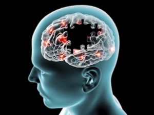 Avance contra el Alzheimer gracias a la resonancia magnética cerebral