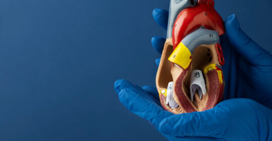 La resonancia magnética cardíaca revela daños ocultos en pacientes con cardiopatía laminosa
