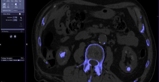 El auge imparable de las pruebas de imagen: clave en cribados, diagnósticos y tratamientos