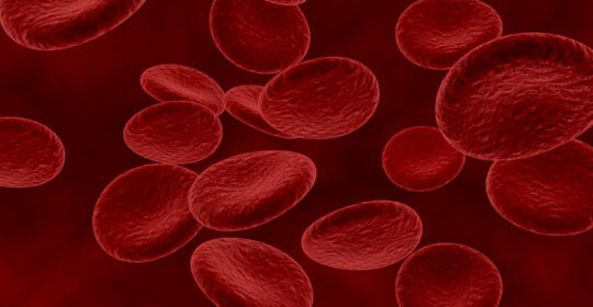 Qué es la Ecografía Doppler vascular y para que sirve