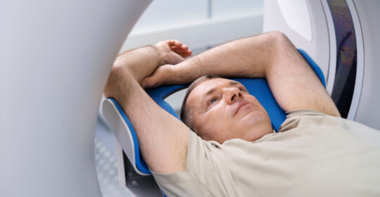 Radioterapia más precisa: menos toxicidad y mejores resultados